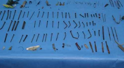 Midesinden tam 158 parça metal çıktı!