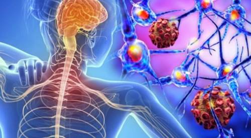 MS hastalığı Türkiye'de her 10 kişiden 1'ini etkiliyor!