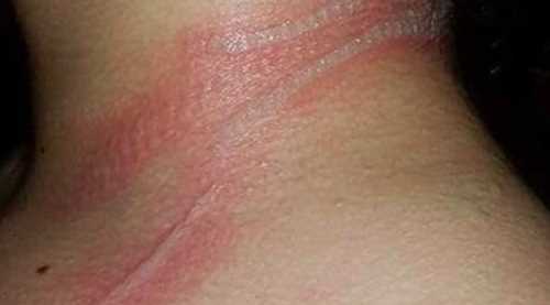 NEDENİ CEP TELEFONU