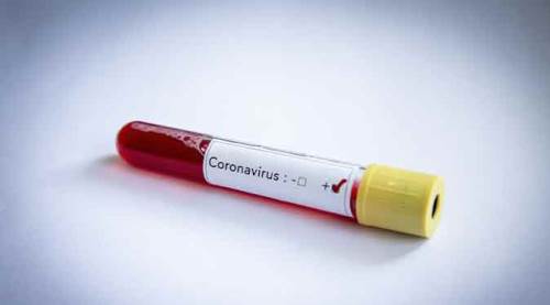 O ismin koronavirüs açıklaması gündemi salladı!