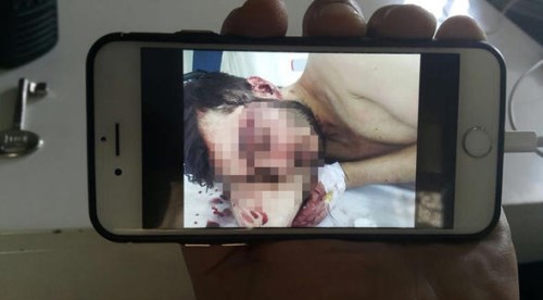 Oklavayla döverek hastanelik ettiler!