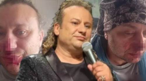 Onur Akay neden entübe edildi? “Et yiyen bakteri” iddiası sonrası dikkat çeken gelişmeler