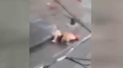 Pitbull sokak ortasında adamı parçaladı