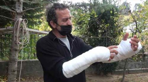 Pitbullu saldırıya uğradı, kolları parçalandı!