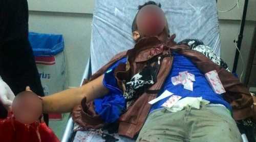 Polise atmak istediği bomba elinde patladı