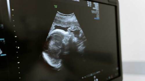 Rüyada Bebeği Ultrasonda Görmek Ne Anlama Gelir?