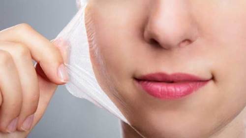 Rüyada Derinin Soyulduğunu Görmek Ne Anlama Gelir?