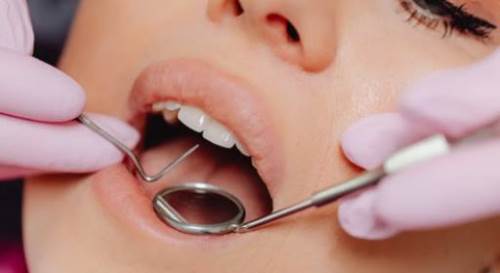 Rüyada Diş Dolgusu Yaptırmak Ne Demek? (Rüya Tabiri)