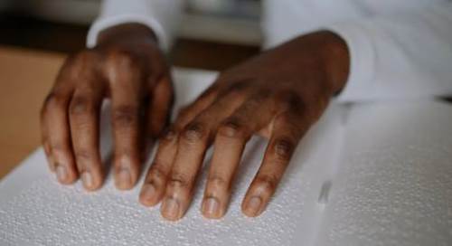 Rüyada Tanıdık Birinin Kör Olduğunu Görmek