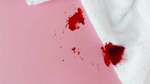 Rüyada Tuvalete Kan İşediğini Görmek Ne Anlama Gelir?