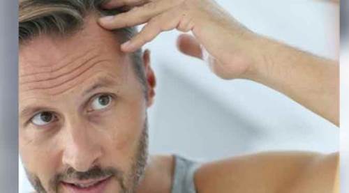 Saç dökülmesi bu yöntemle engelleniyor