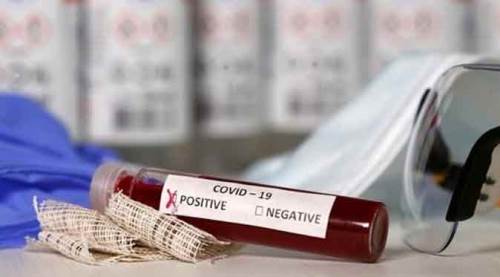 Sağlık Bakanı Fahrettin Koca Türkiye'nin son koronavirüs verilerini açıkladı!