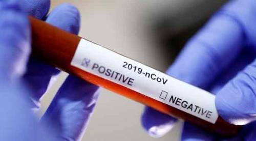 Sağlık Bakanı son 24 saatin verilerini açıkladı