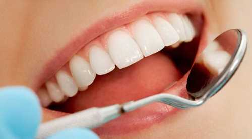 Sararmış dişler yüzünden gülemiyorsanız