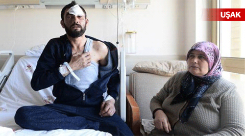 Şarj cihazı patladı, ölümden döndü!