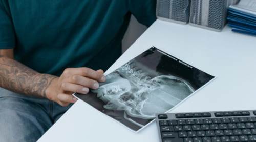 Servikal Vertebra Nedir?