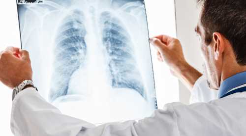 SGK'DAN KANSER HASTALARINA DARBE!