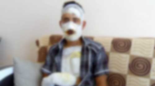 Sivaslı askeri kolonya döküp yaktılar