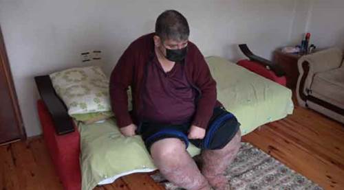 Sivrisinek ısırığı hayatını kararttı!