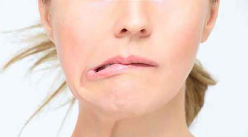 Soğuk hava ve rüzgâr yüz felcini tetikliyor