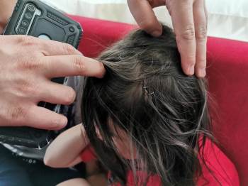 Sokak Köpeği 6 Yaşındaki Kız Çocuğuna Dehşeti Yaşattı
