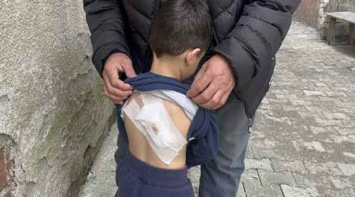 Sokak köpekleri saldırdı: Küçük çocuk ölümden döndü