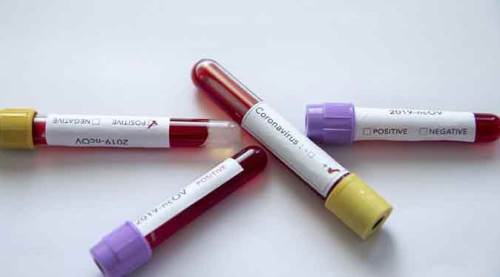 Son 24 saatte vaka sayısındaki artış...