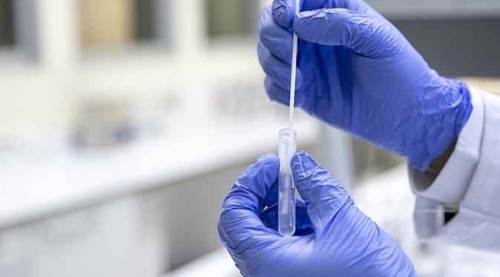 Tablo kötü: Vakalar haziran başından bu yana 8 kat arttı!