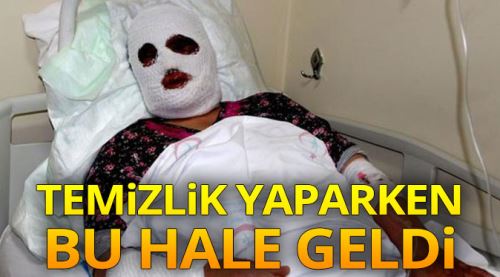 Temizlik yaparken bu hale geldi