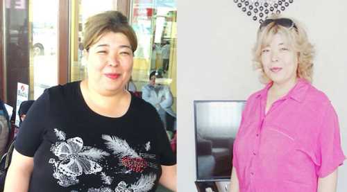 TÜP MİDE AMELİYATI İLE 47 KİLO VERDİ