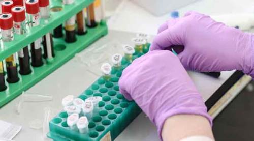 Türkiye’de 1 milyonu aşkın kişiye bu tarama yapıldı