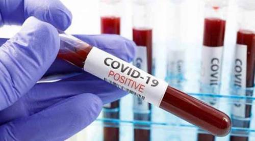 Türkiye'de bugün tespit edilen vaka sayısı...