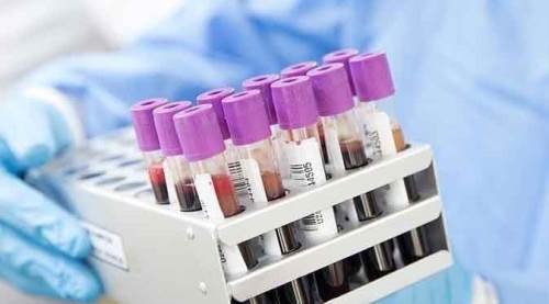 Türkiye'de de görülmesinin ardından kritik maymun çiçeği uyarısı!