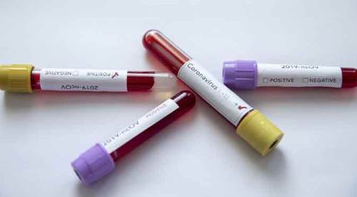 Türkiye'de güncel koronavirüs vaka ve ölü sayısı açıklandı! Son dakika