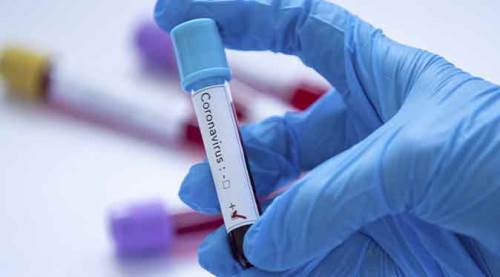 Türkiye'de koronavirüs kaynaklı can kaybı sayısı 4007 oldu