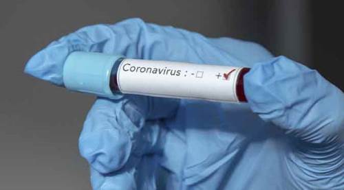 Türkiye'de koronavirüs kaynaklı ölü sayısı 3 bin 397 oldu