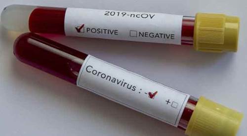 Türkiye'de koronavirüs kaynaklı ölü sayısı 3 bin 841'e yükseldi