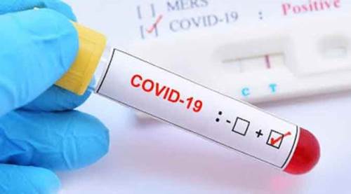 Türkiye'de koronavirüs ölü ve vaka sayısı kaç oldu?