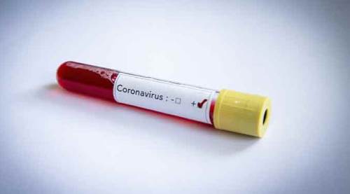 Türkiye'de koronavirüs salgınında son durum