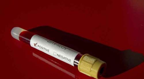 Türkiye'de koronavirüs vaka sayısı 120 bin 204 oldu