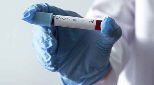 Türkiye'de koronavirüs vaka sayısı 146 bin 457 oldu