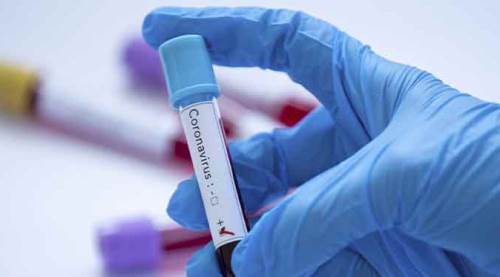 Türkiye’de koronavirüs vaka sayısı 82.329'a yükseldi!