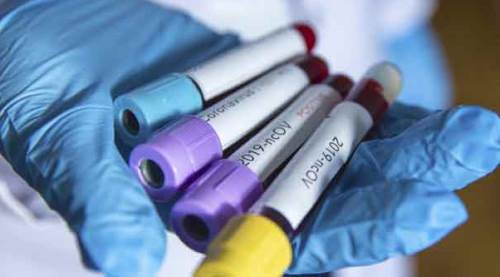 Türkiye'de koronavirüsten can kaybı 3 bin 641'e yükseldi