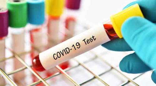 Türkiye'de koronavirüsten hayatını kaybedenlerin sayısı 4 bin 340 oldu