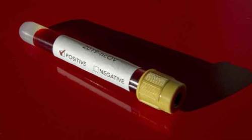 Türkiye'de koronavirüsten ölenlerin sayısı 59 oldu