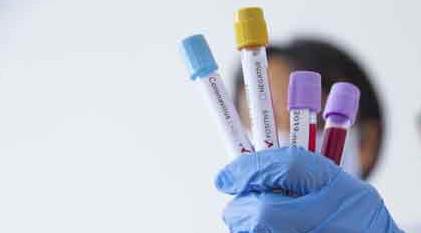 Türkiye'de koronavirüsün 9 Haziran 2020 tablosu