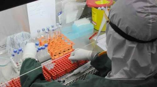 Türkiye’de salgından ölenlerin sayısı bugün...