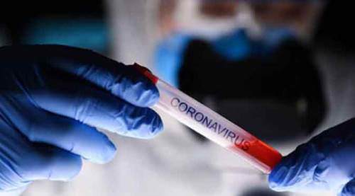 Türkiye'de son 24 saatte 5 bin 856 yeni vaka!