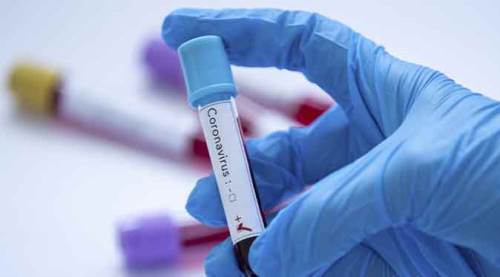 Türkiye’de son 24 saatte tespit edilen vaka sayısı ...