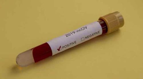 Türkiye'de son durum! Bakan Koca son verileri açıkladı...